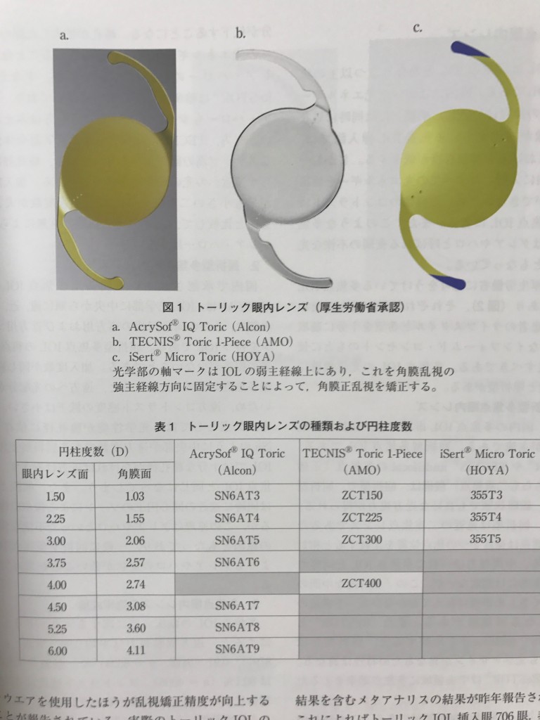 これでわかる! 高機能眼内レンズ - その他